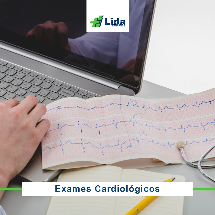 Exames Cardiológicos - Lida Exames Sorocaba