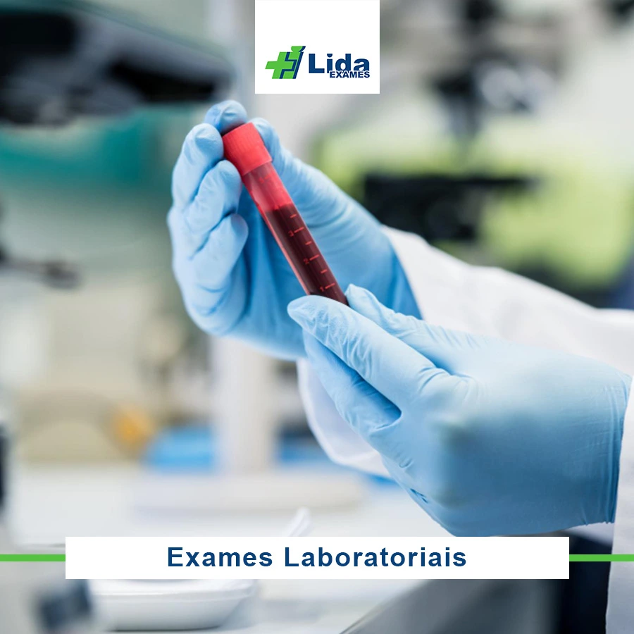Exames Laboratoriais - Lida Exames Sorocaba